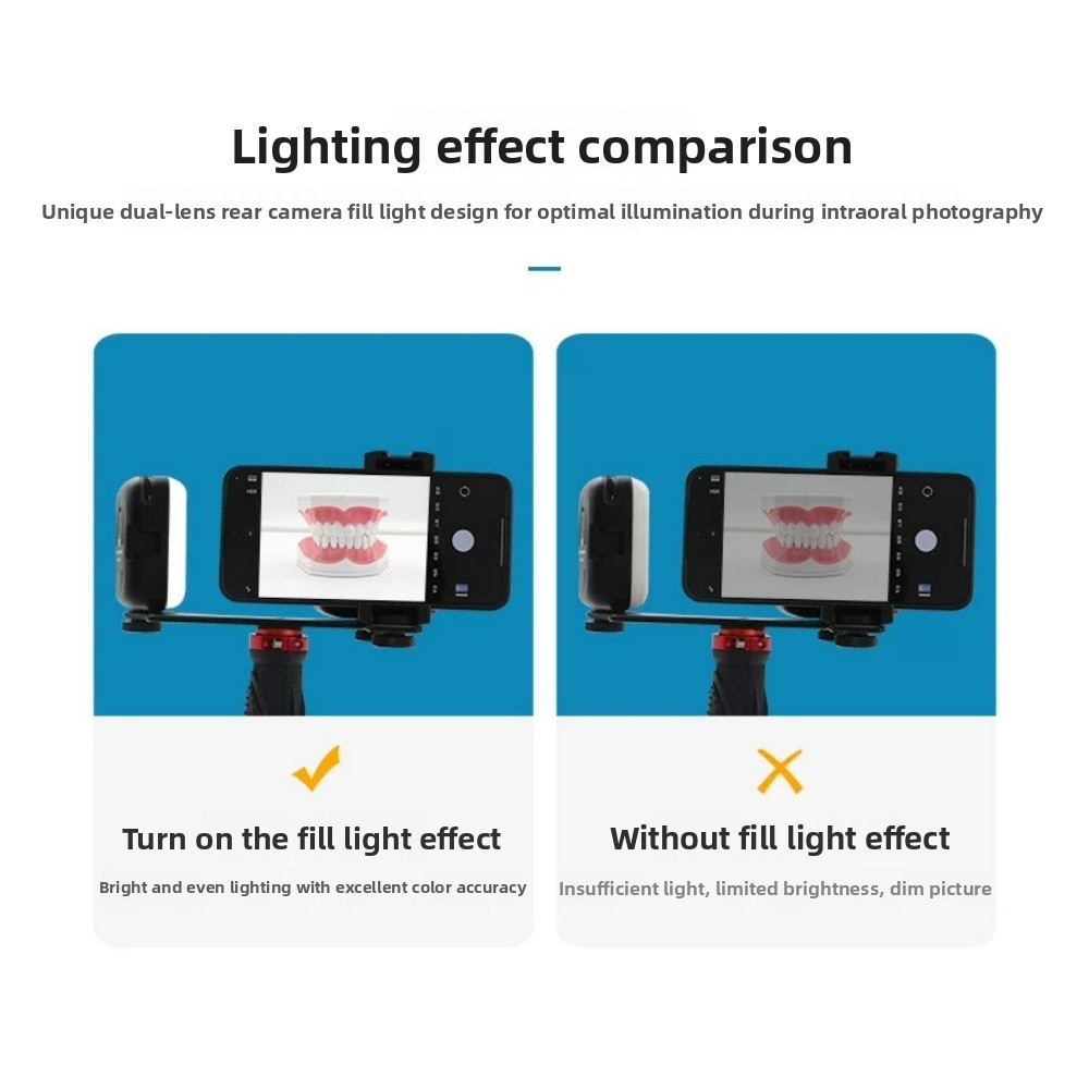 Dental Photography Light, Blue - Lighting Gallery 评论和价格
